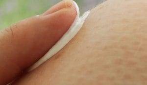 Pitiriasi rosea di Gibert