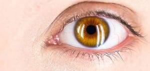 Cataratta una delle affezioni piu comuni de occhio