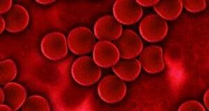 Globuli rossi bassi quando allarmarsi e perche