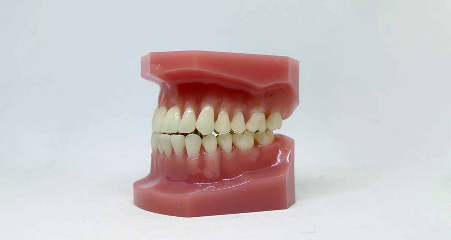 Diabete e gengive un collegamento con la salute dentale