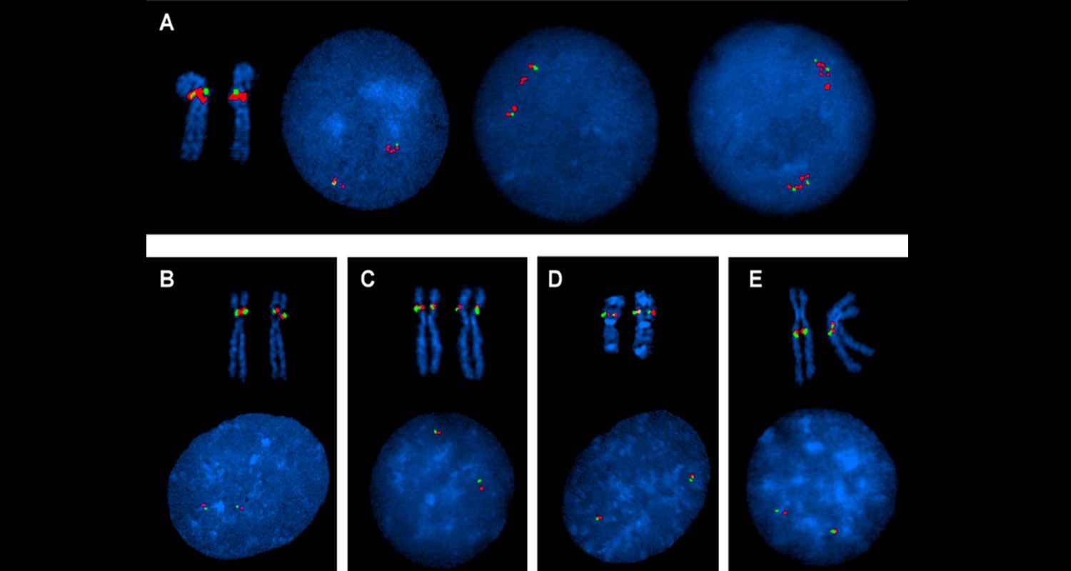 Gli uomini hanno un cromosoma sessuale in piu