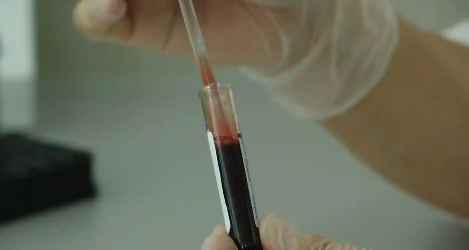 Globuli bianchi alti cosa mangiare per aiutare